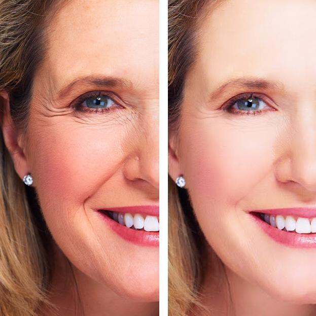 Age Perfect Glow – Night Repair Set